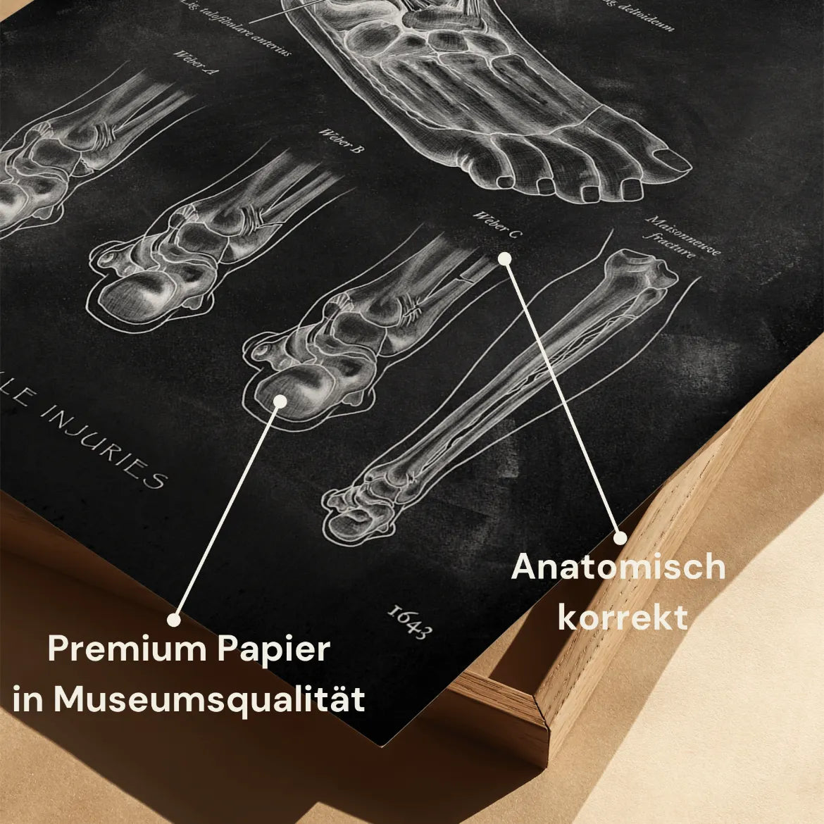 Sprunggelenk mit Bänderriss - Chalkboard - Animus Medicus GmbH