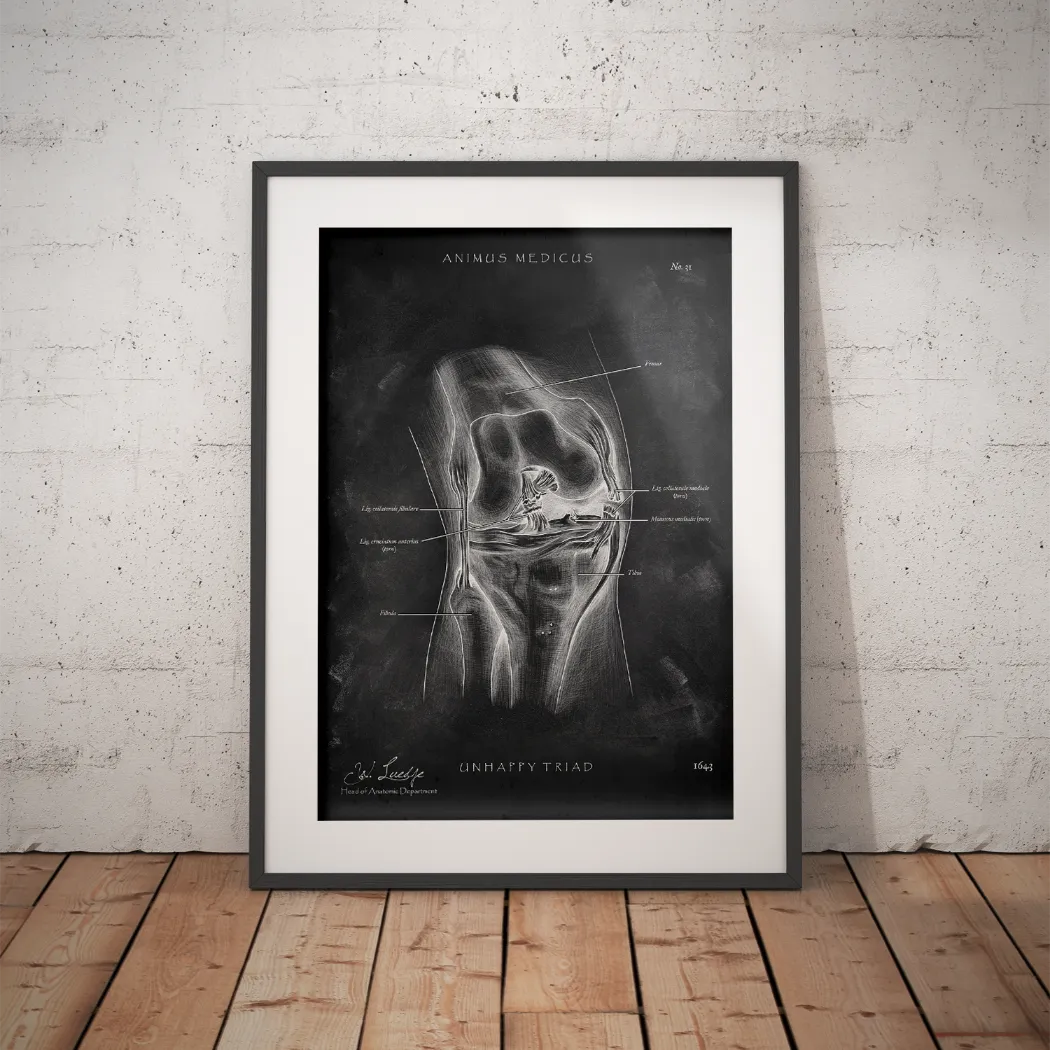 Unhappy Triad Knie - Chalkboard - Animus Medicus GmbH