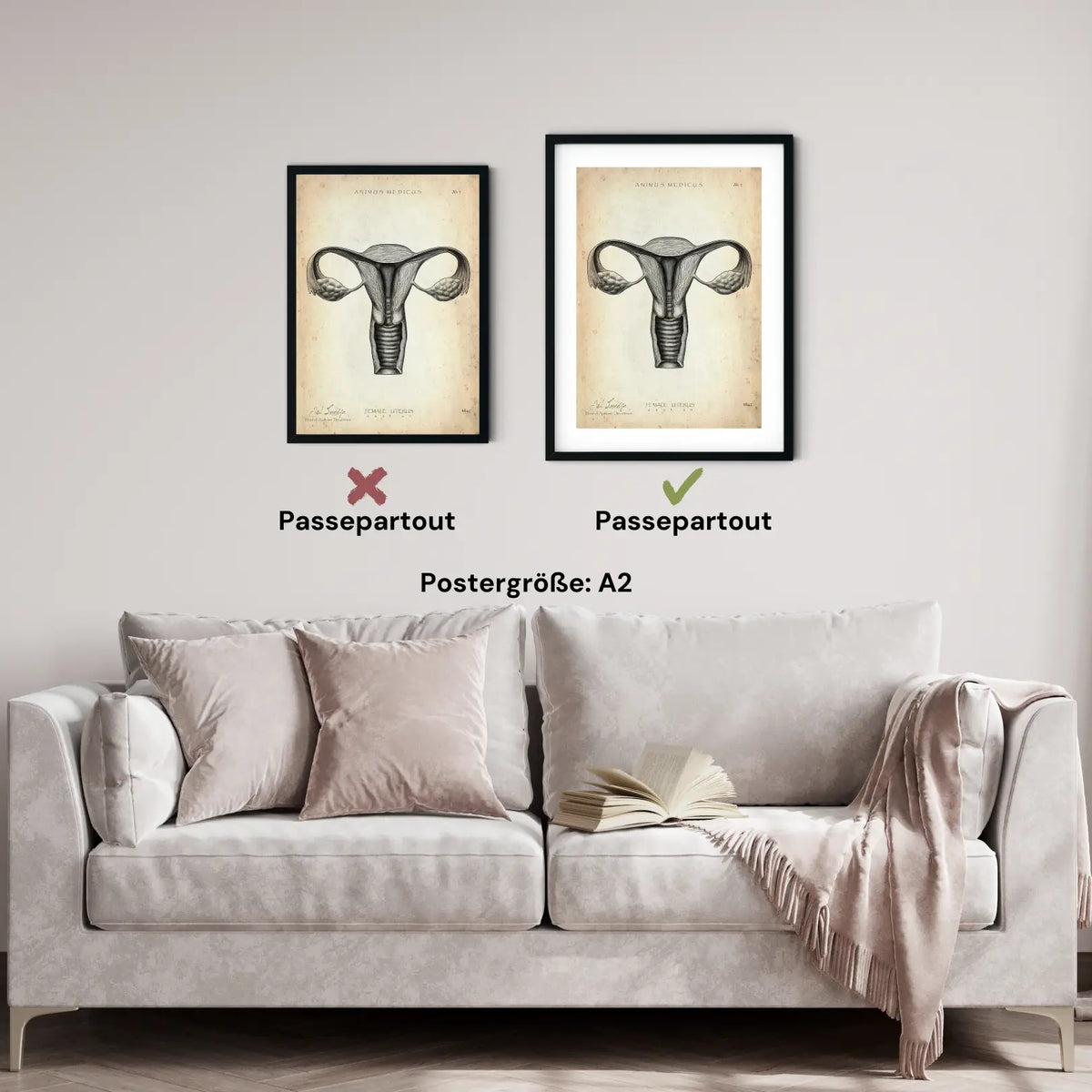 Uterus Anatomie - Animus Medicus GmbH