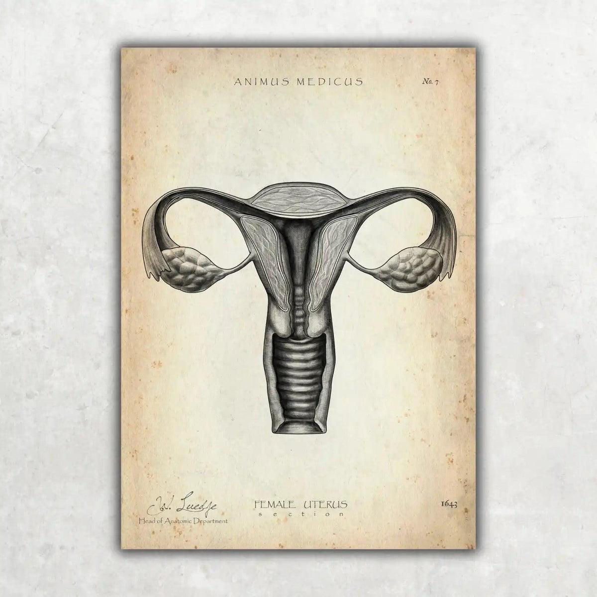Uterus Anatomie - Animus Medicus GmbH