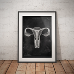 Uterus Anatomie - Chalkboard - Animus Medicus GmbH