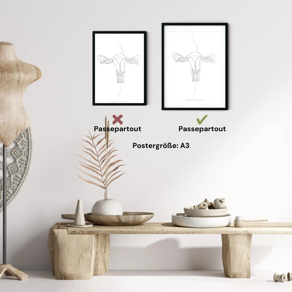 Uterus Anatomie Minimalist - Animus Medicus GmbH