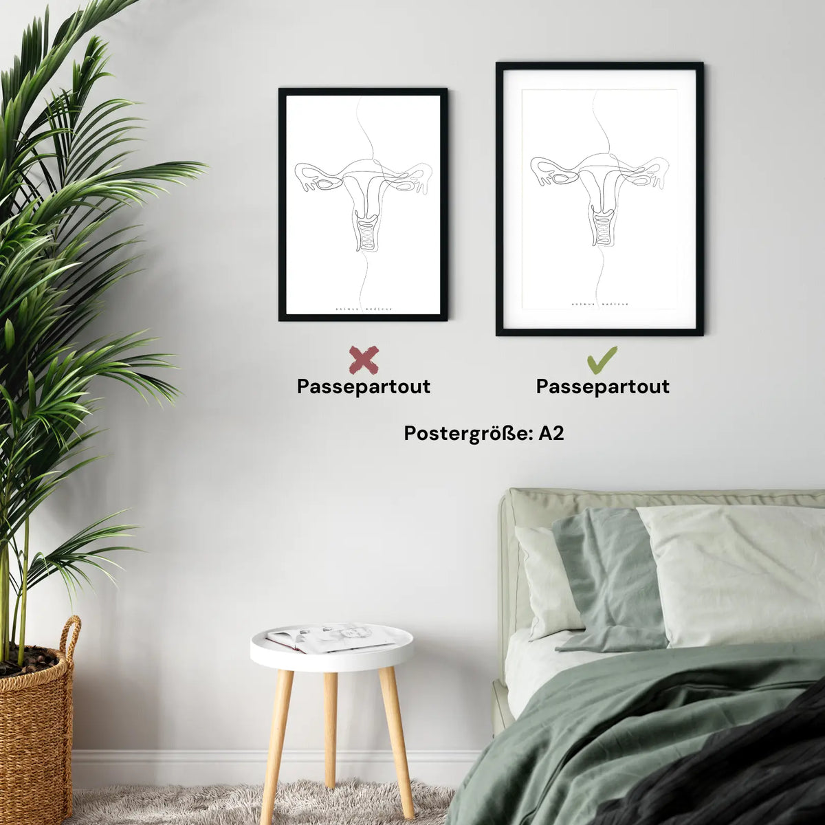 Uterus Anatomie Minimalist - Animus Medicus GmbH