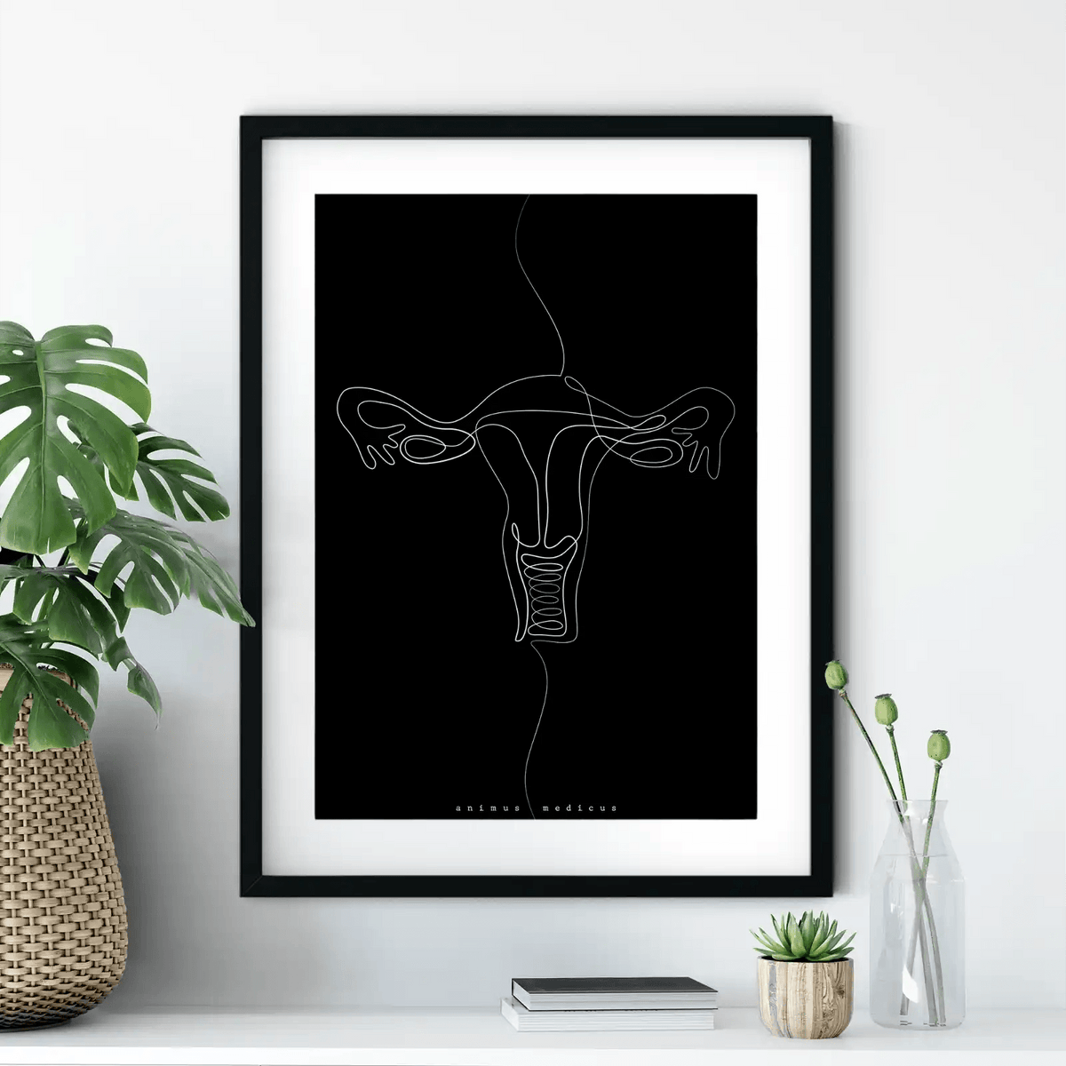 Uterus Anatomie Minimalist Dark - Animus Medicus GmbH