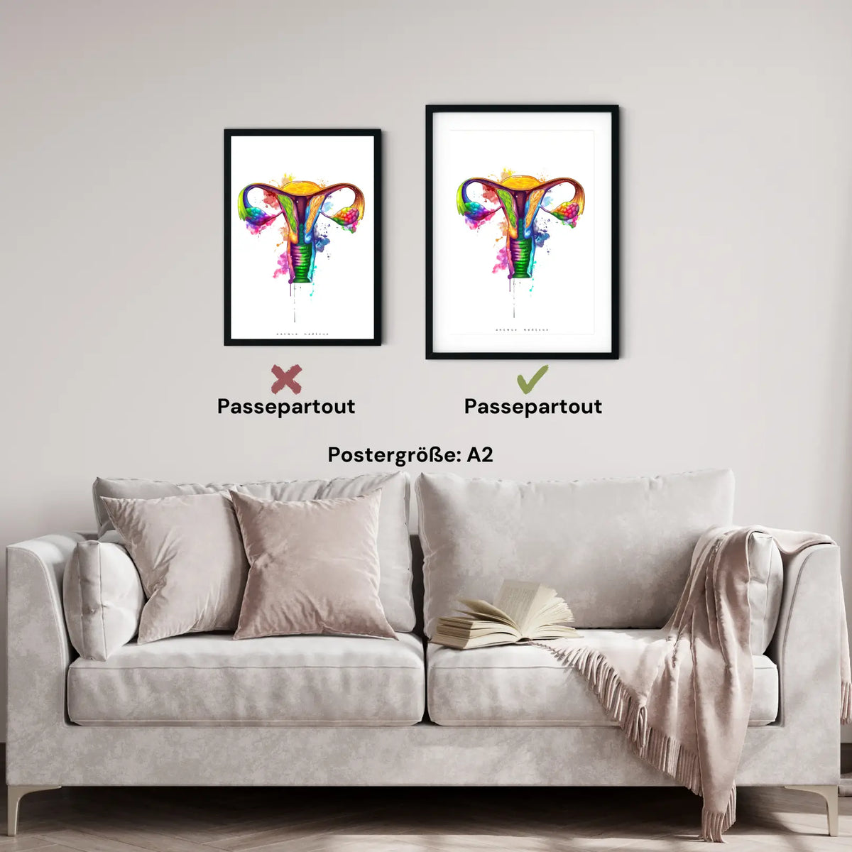 Uterus Anatomie - Rainbow - Animus Medicus GmbH
