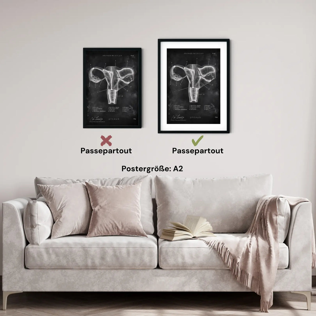 Uterus mit Adnexe - Chalkboard - Animus Medicus GmbH