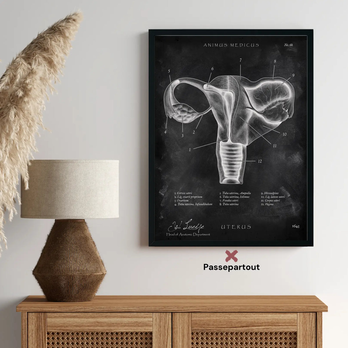 Uterus mit Adnexe - Chalkboard - Animus Medicus GmbH