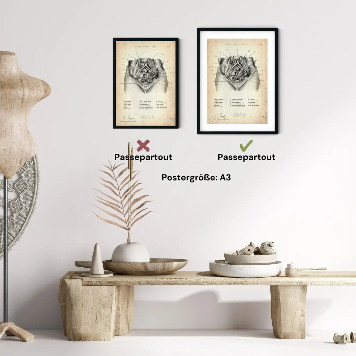 Weibliche Genitalien - Animus Medicus GmbH