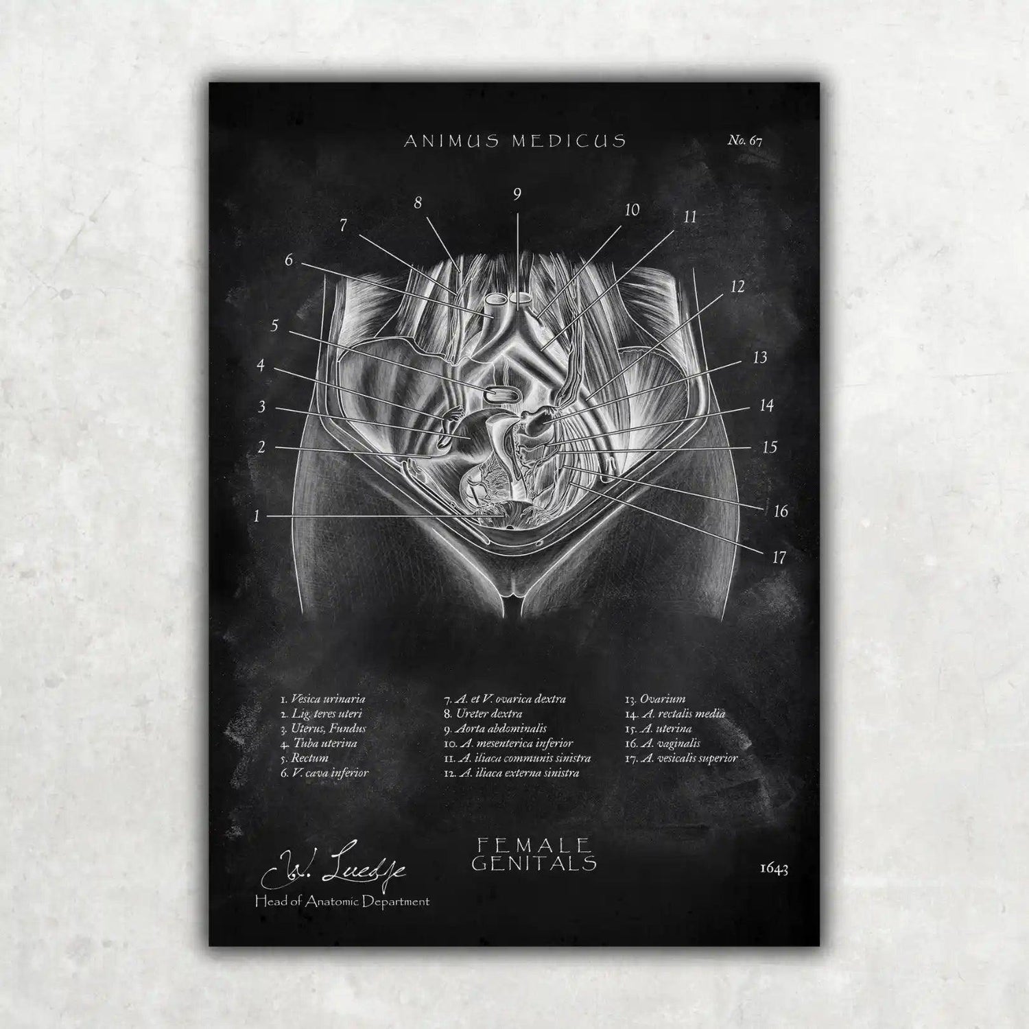 Weibliche Genitalien - Chalkboard - Animus Medicus GmbH