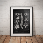 Wirbelkörper Anatomie - Chalkboard - Animus Medicus GmbH