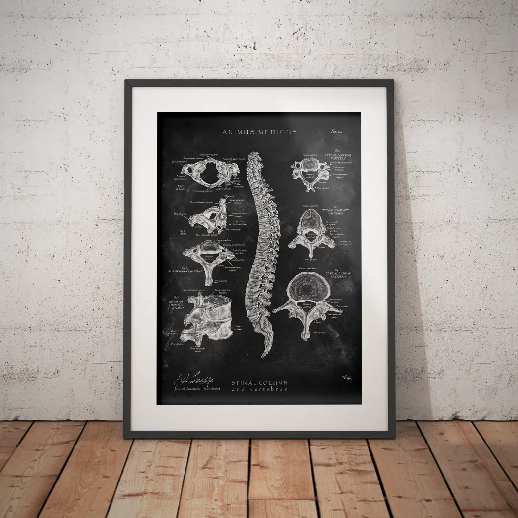Wirbelkörper Anatomie - Chalkboard - Animus Medicus GmbH