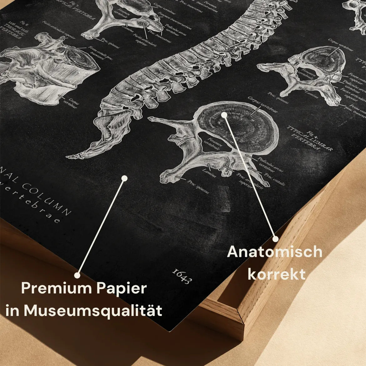 Wirbelkörper Anatomie - Chalkboard - Animus Medicus GmbH