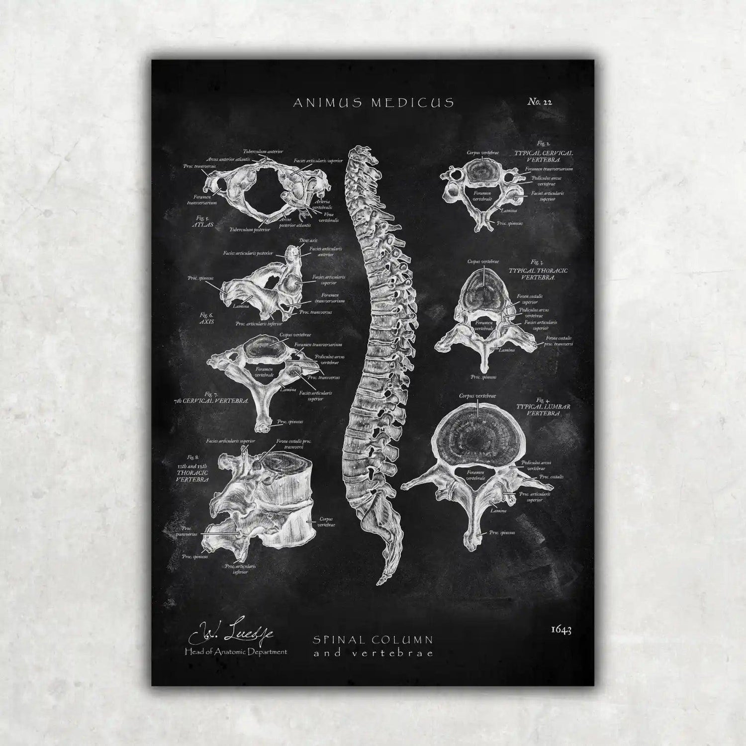 Wirbelkörper Anatomie - Chalkboard - Animus Medicus GmbH