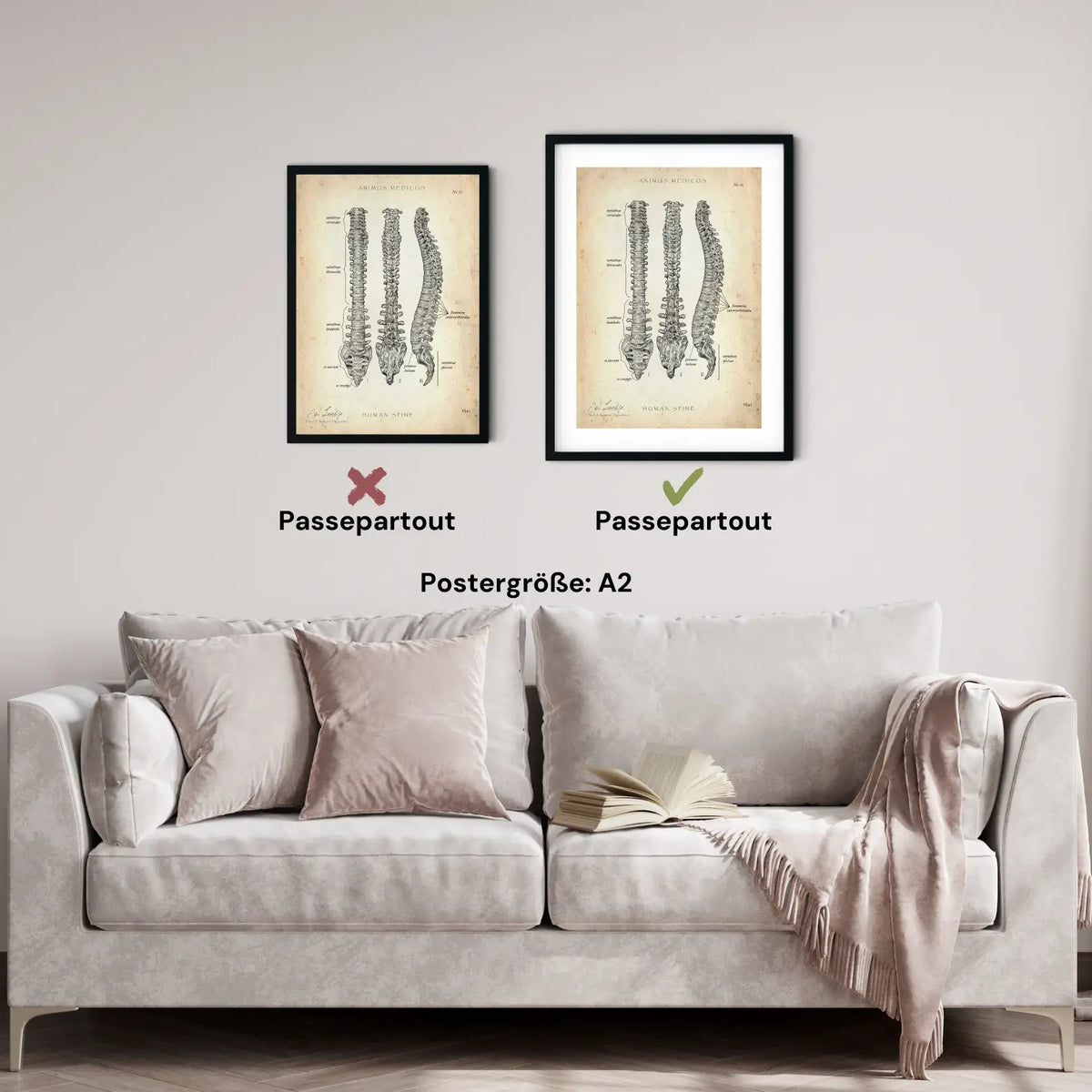 Wirbelsäule | Aufbau und Anatomie - Animus Medicus GmbH