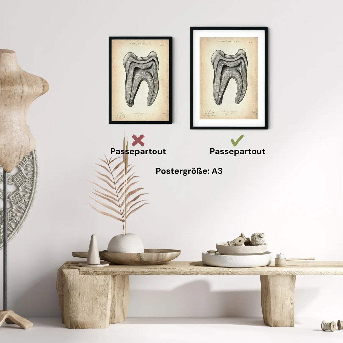 Zahn Anatomie im Querschnitt - Animus Medicus GmbH