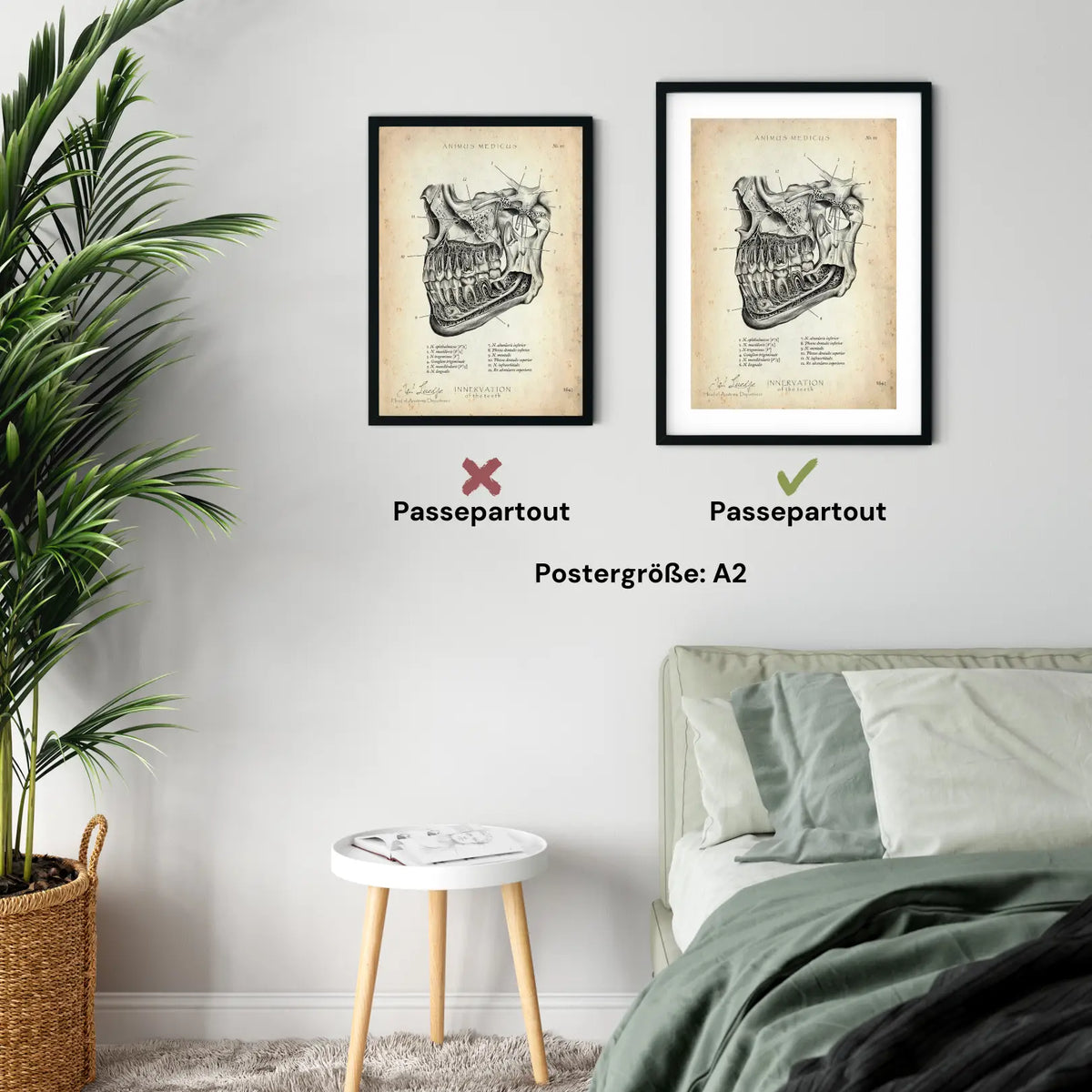 Zahn Innervation - Animus Medicus GmbH