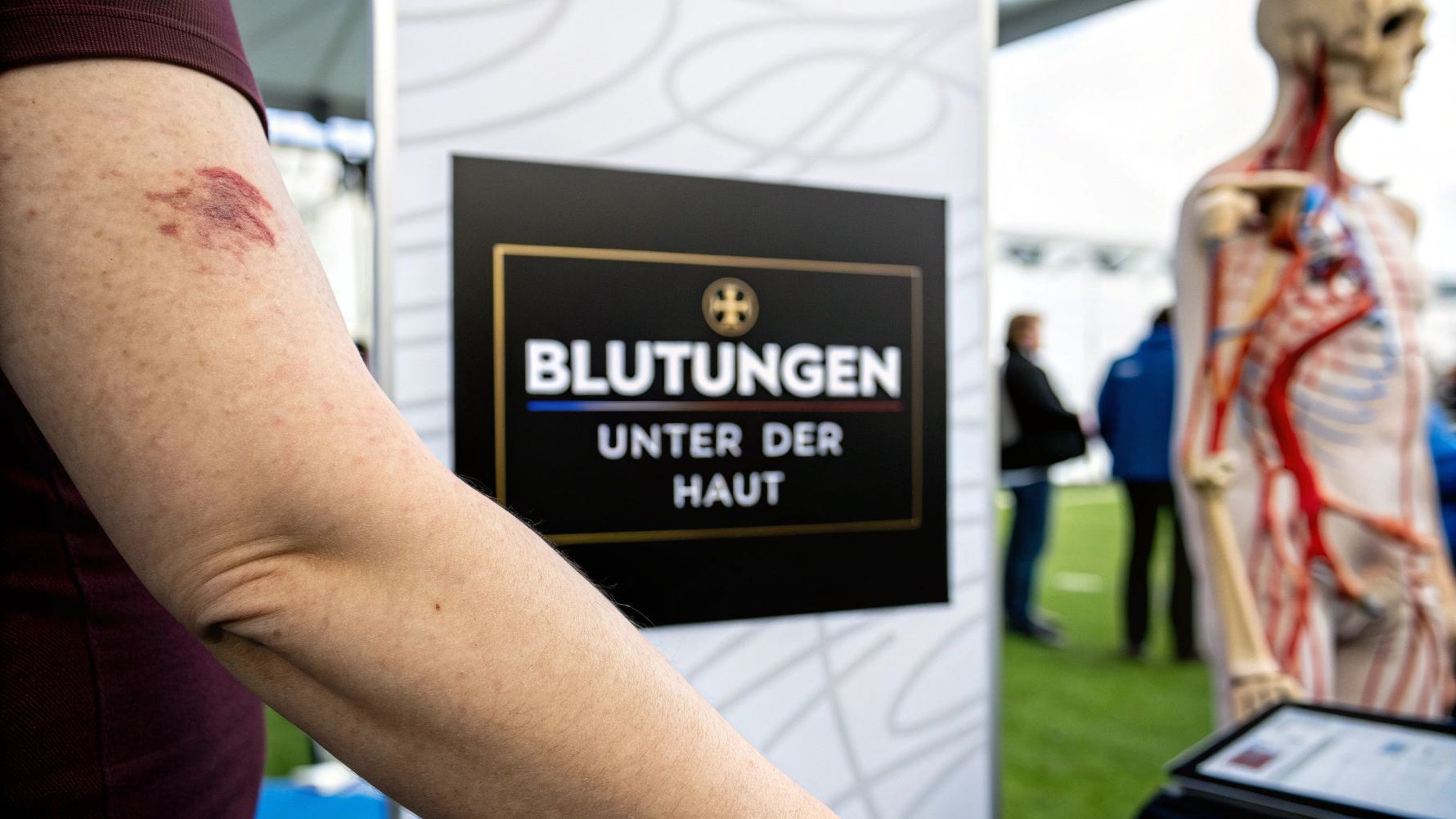 Was Blutungen unter der Haut wirklich bedeuten