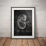 Nieren Anatomie - Schoolbord