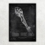 Dorsale arm anatomie - schoolbord