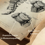 Hernia Anatomie Poster