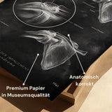 Schouderimpingement - Chalkboard