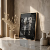 Beenspieren Anatomie - Chalkboard