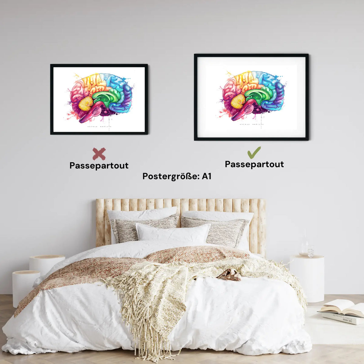 Gehirn Anatomie - Rainbow - Animus Medicus GmbH