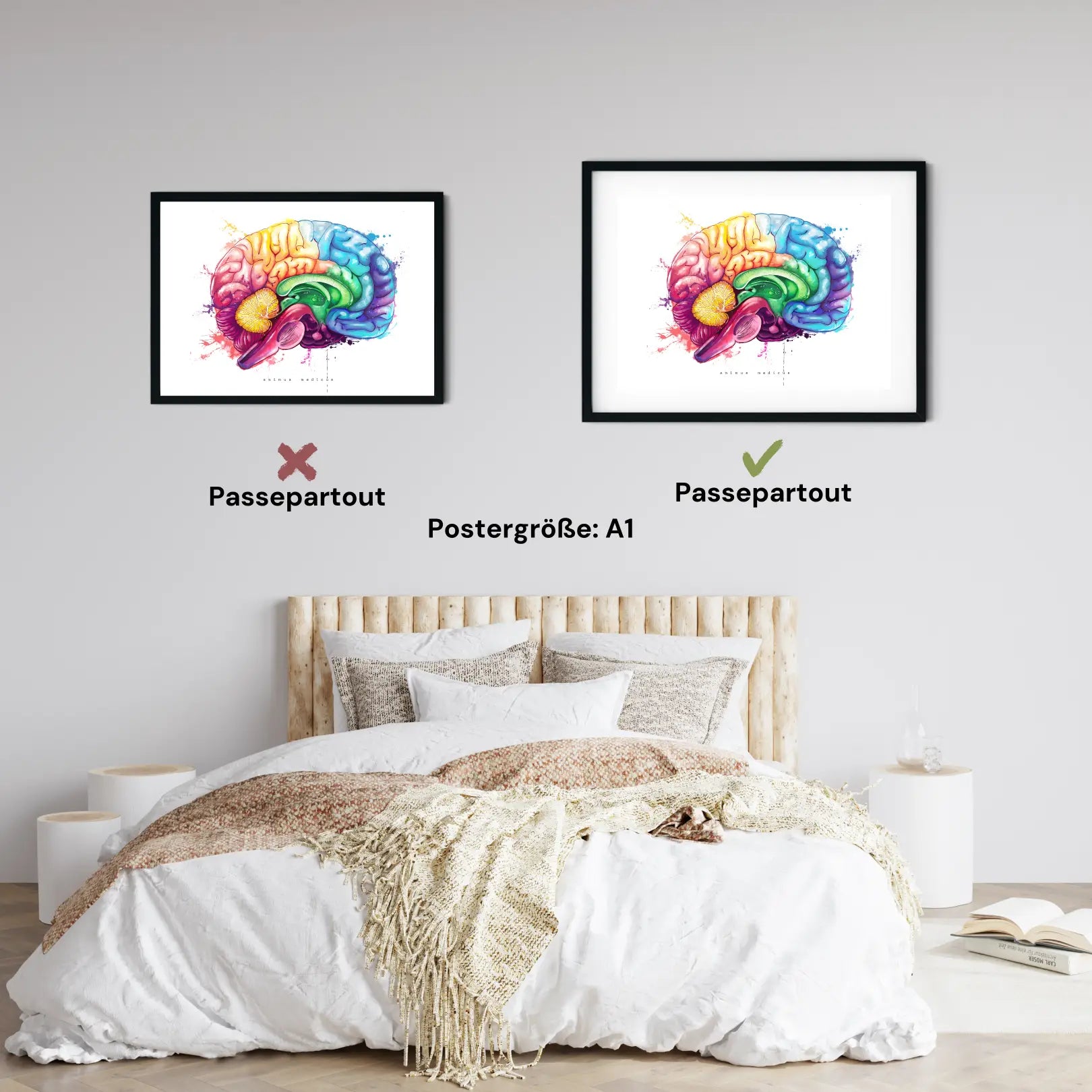 Gehirn Anatomie - Rainbow - Animus Medicus GmbH