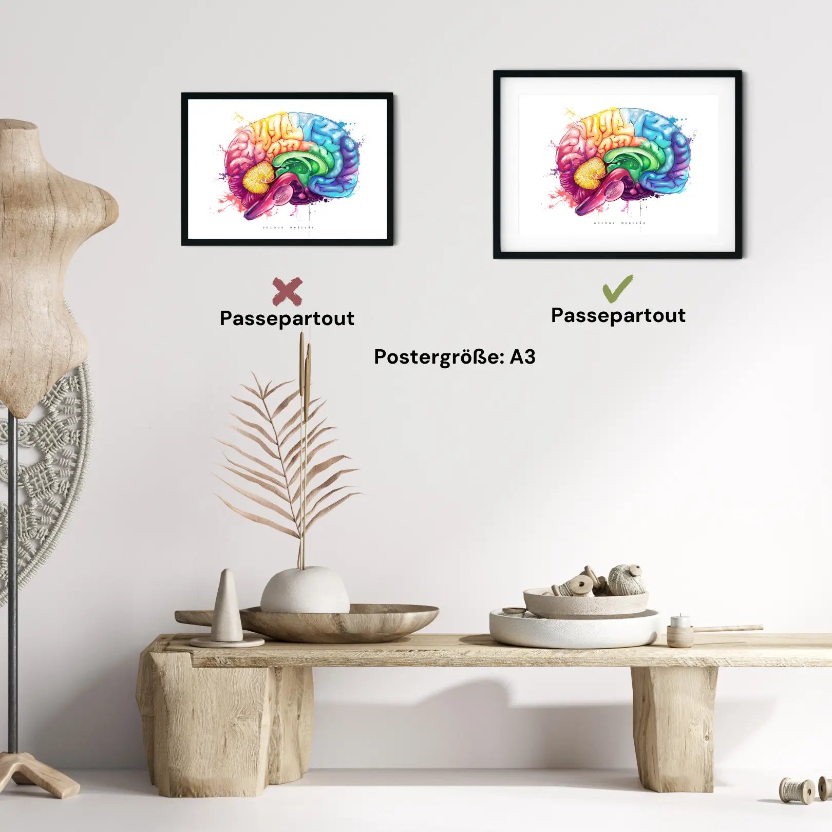Gehirn Anatomie - Rainbow - Animus Medicus GmbH