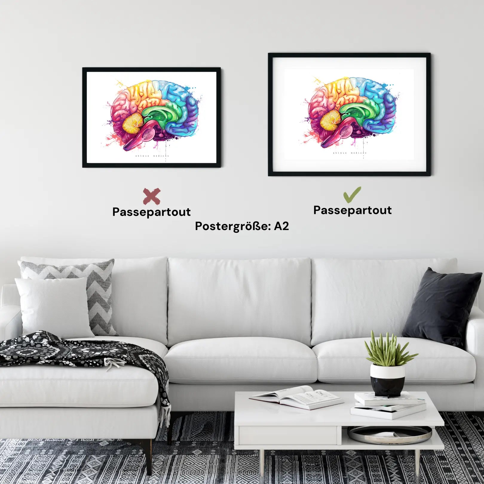 Gehirn Anatomie - Rainbow - Animus Medicus GmbH