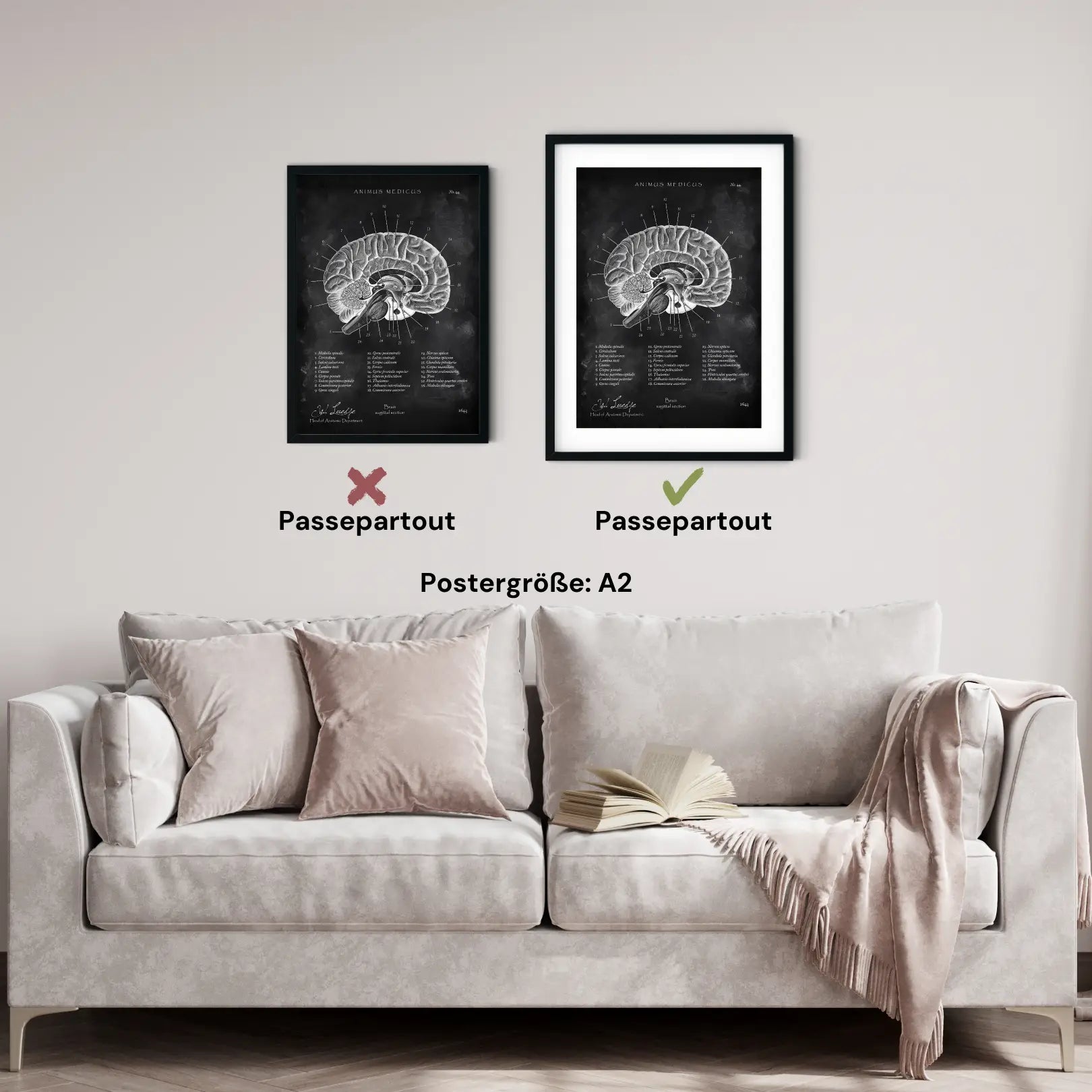 Gehirn im Sagittalschnitt - Chalkboard - Animus Medicus GmbH