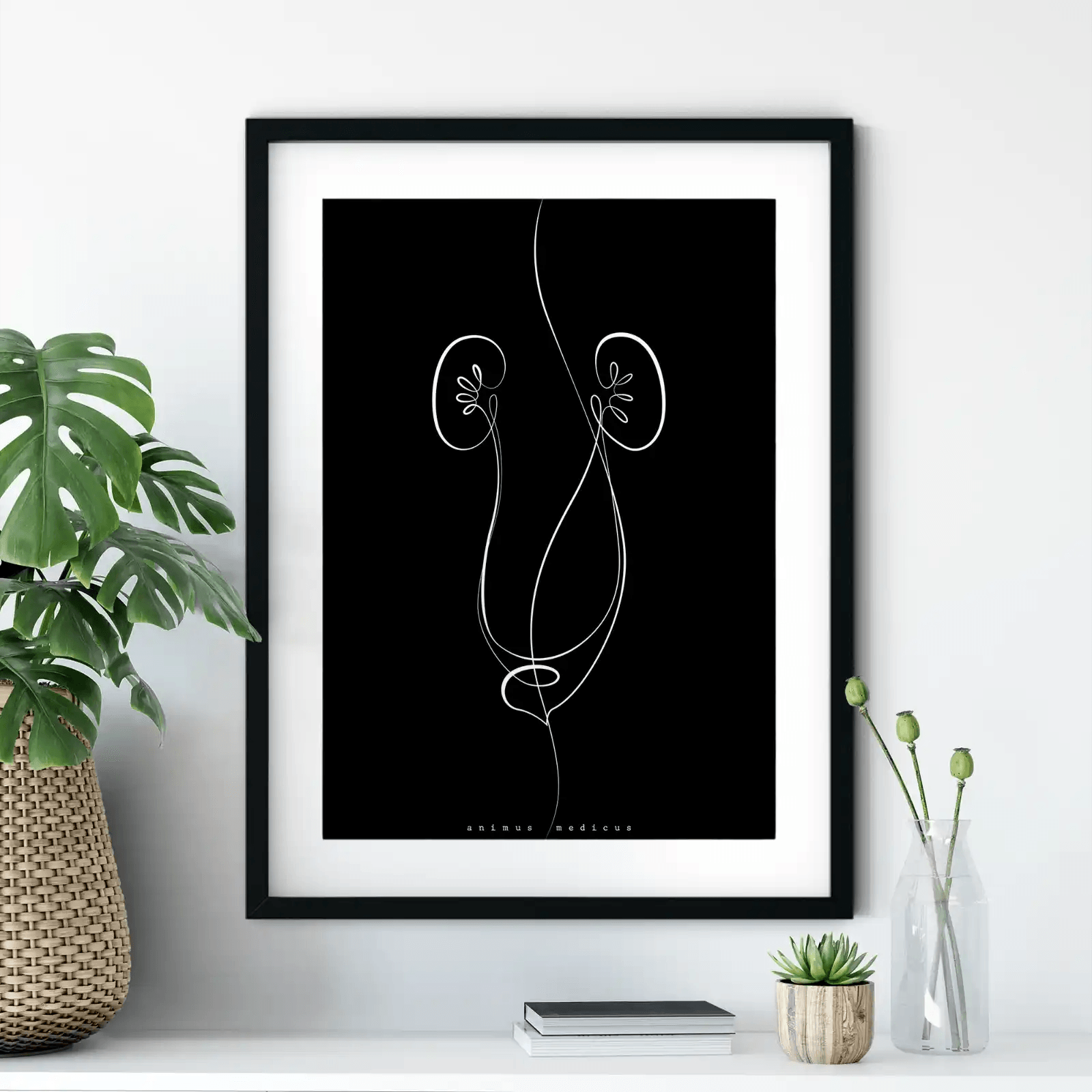 Nieren Anatomie Minimalist Dark - Animus Medicus GmbH