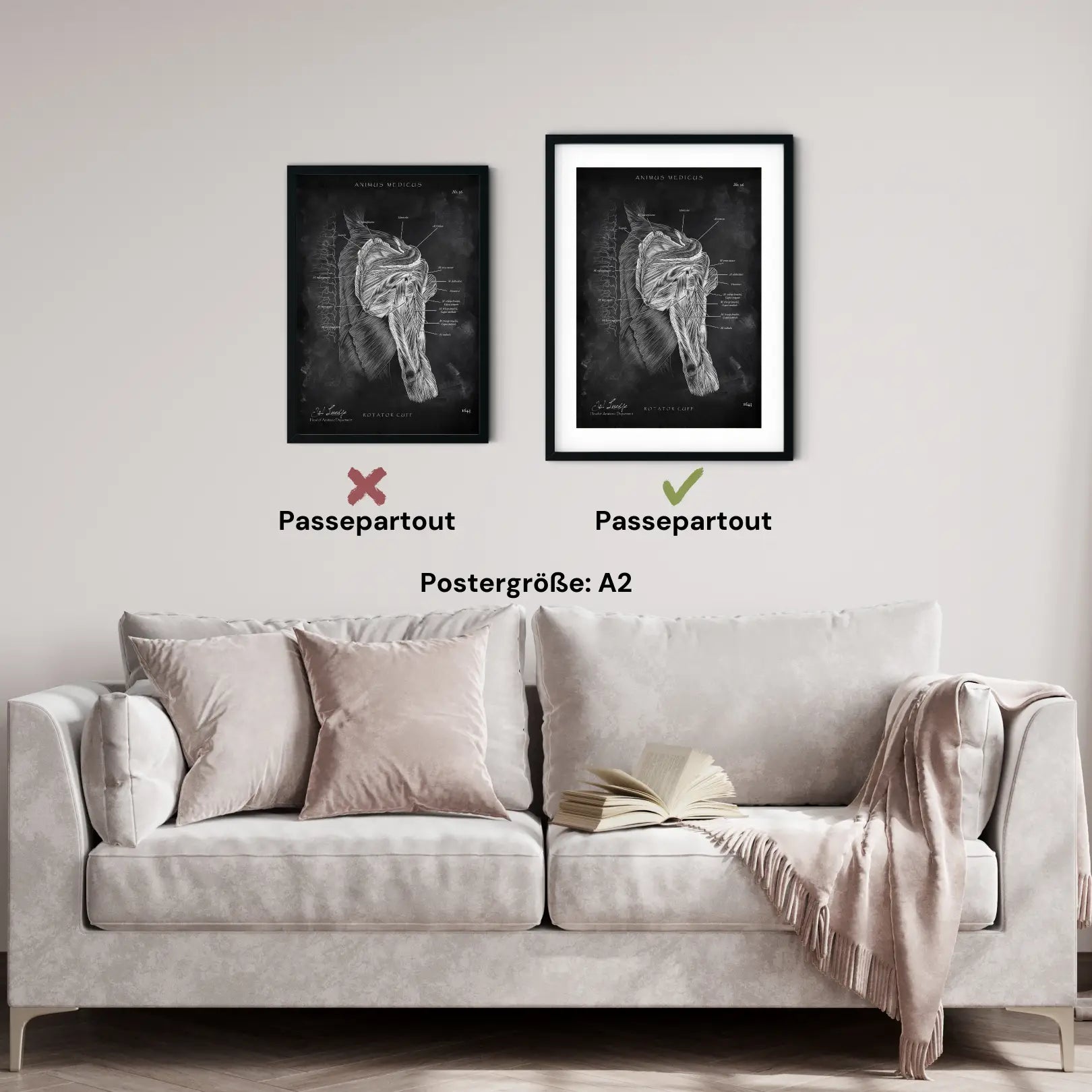 Rotatorenmanschette Anatomie - Chalkboard - Animus Medicus GmbH
