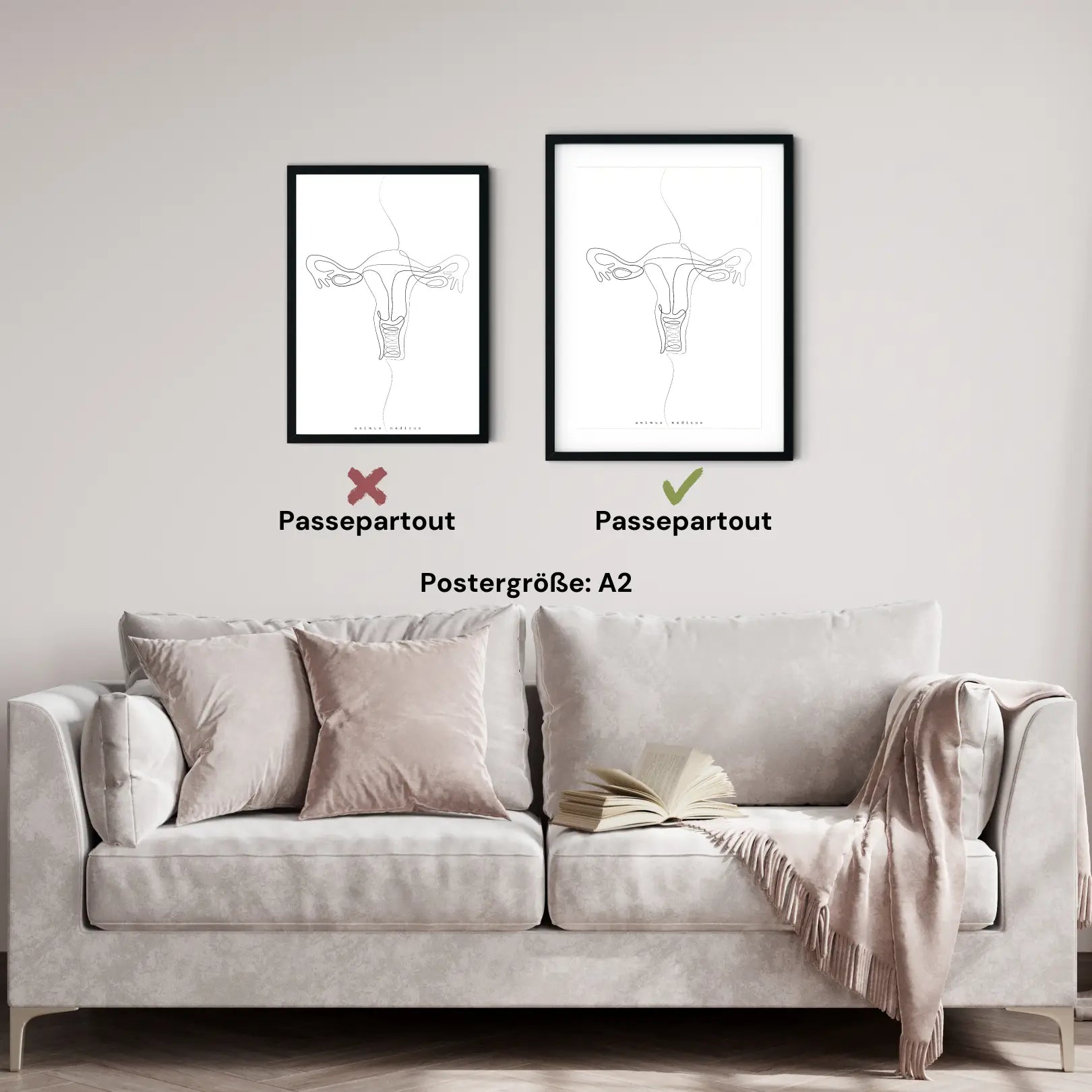 Uterus Anatomie Minimalist - Animus Medicus GmbH