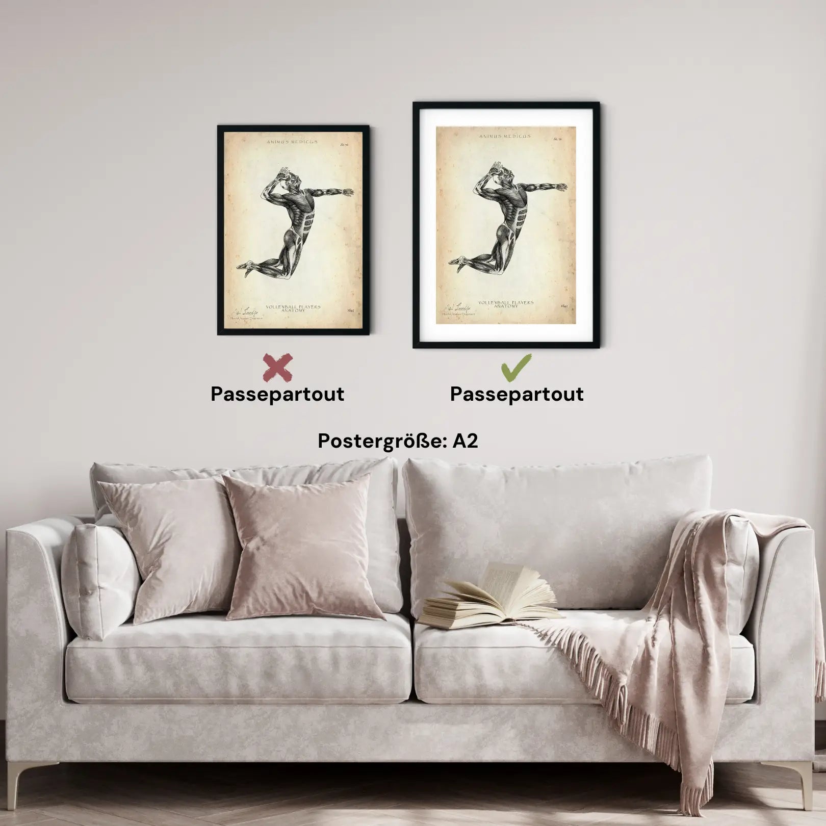 Volleyball Anatomie Poster - Animus Medicus GmbH