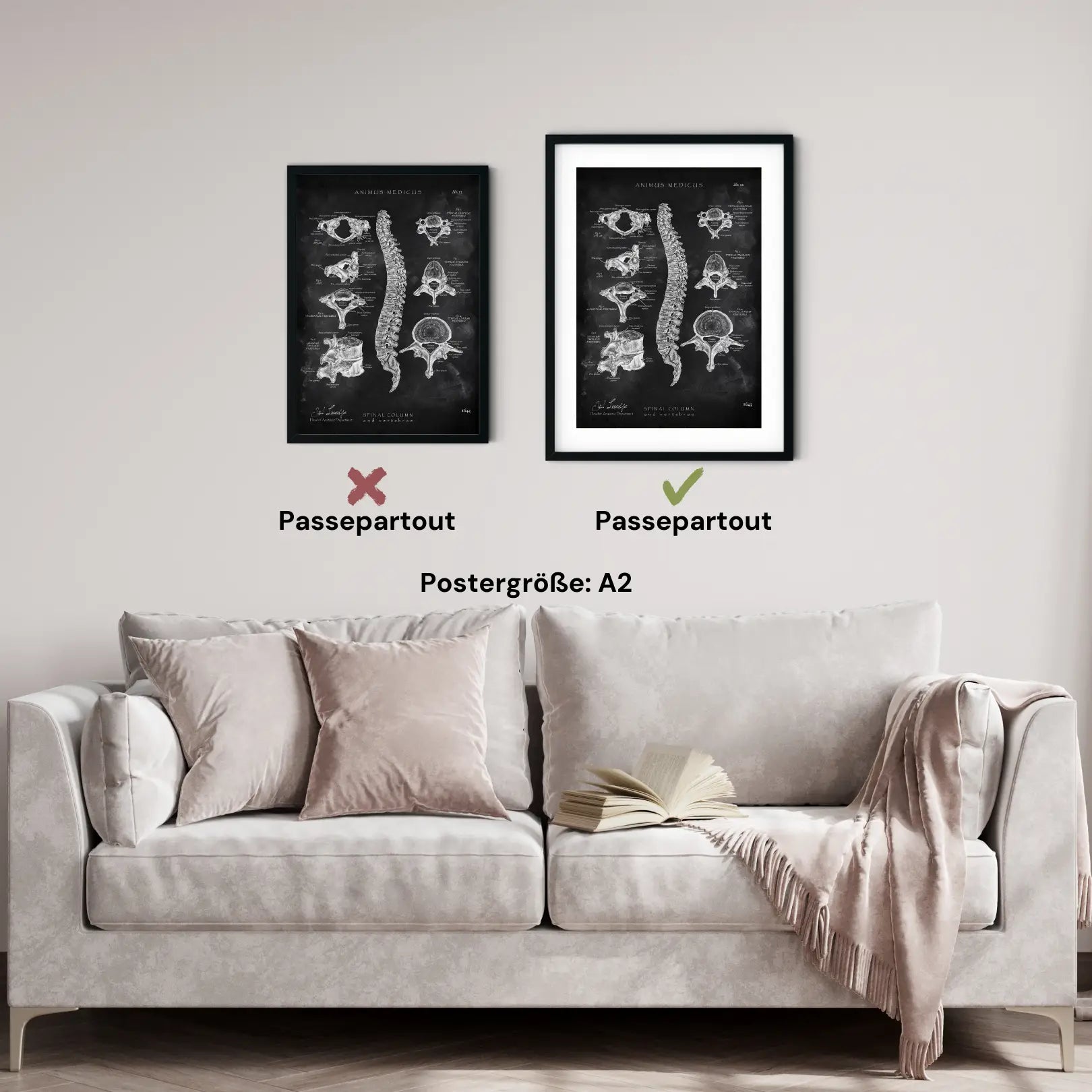Wirbelkörper Anatomie - Chalkboard - Animus Medicus GmbH