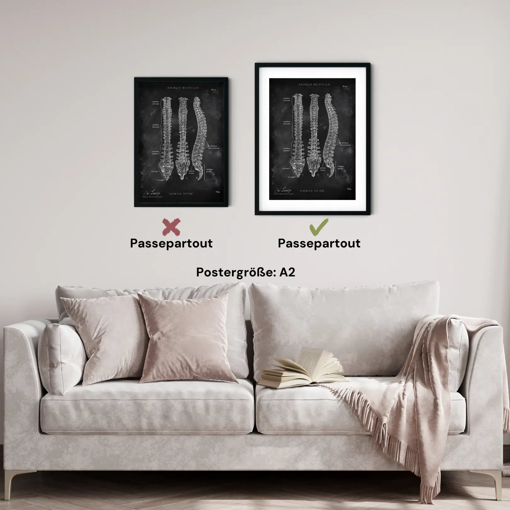 Wirbelsäule | Aufbau und Anatomie - Chalkboard - Animus Medicus GmbH